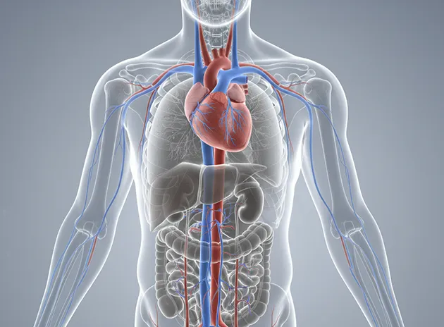 Open Class Action Settlement over IVC