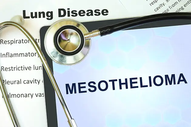 Legal action related to Did you or a loved one develop mesothelioma as a result of asbestos exposure?